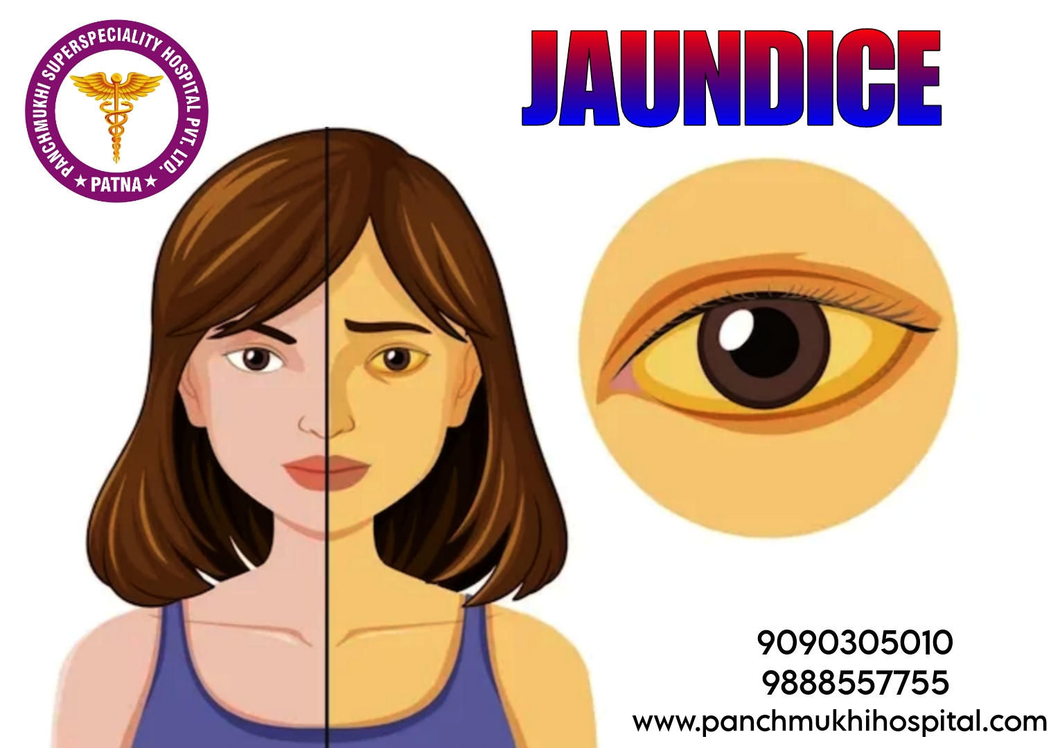 Jaundice can be Dangerous for People if not Treated on Time